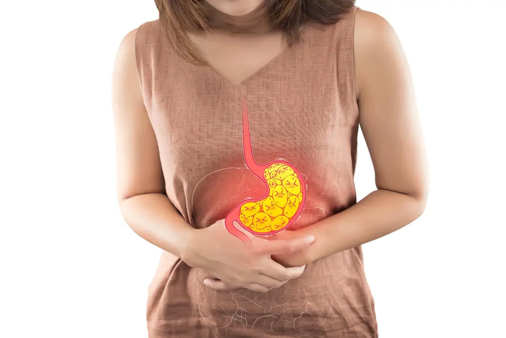 Gastroesophageal Reflux Disease (GERD)